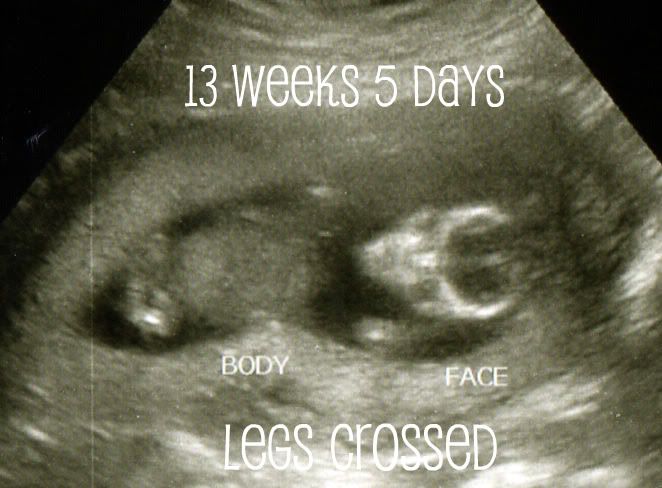 please-tell-me-if-you-can-see-anything-13-weeks-5-days-in-ultrasound