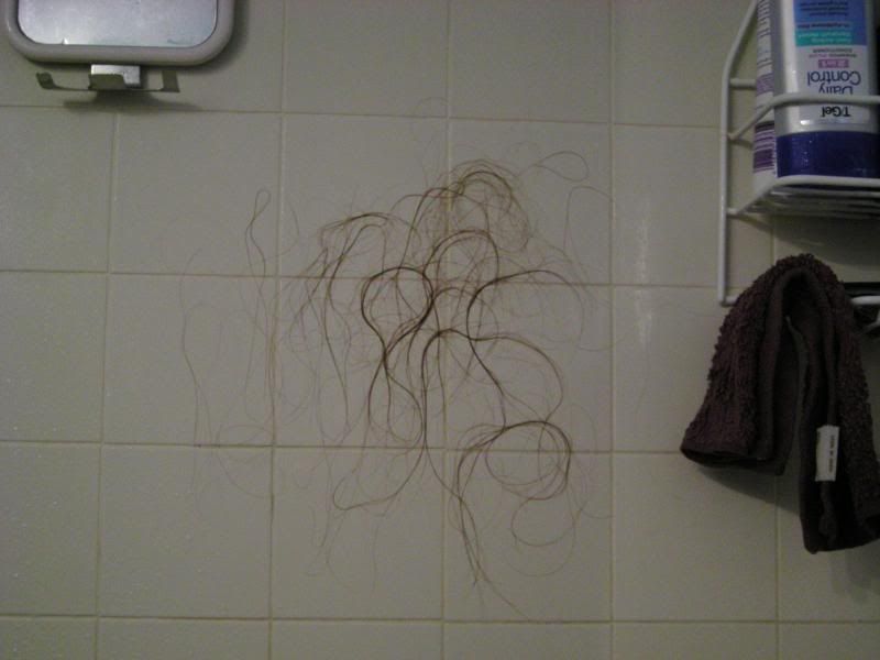 hair photo:hair loss in women 