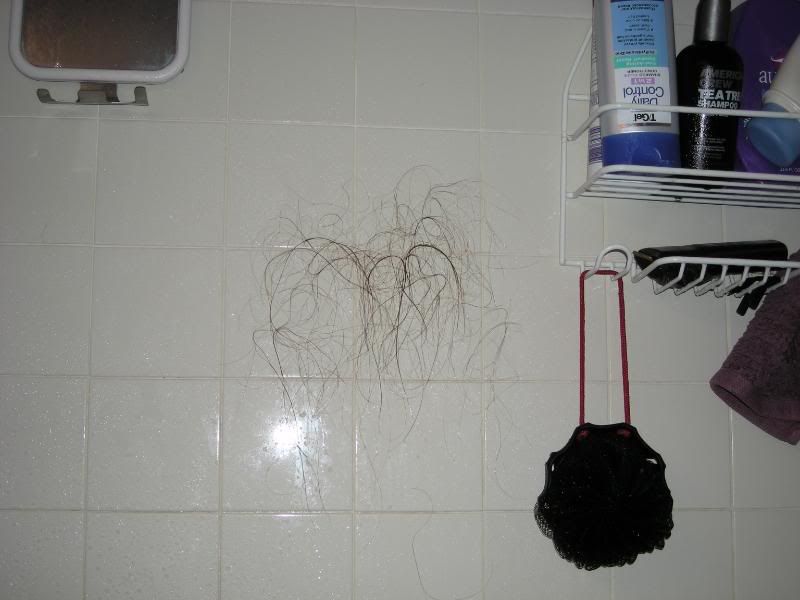 hair photo:iodine hair loss 